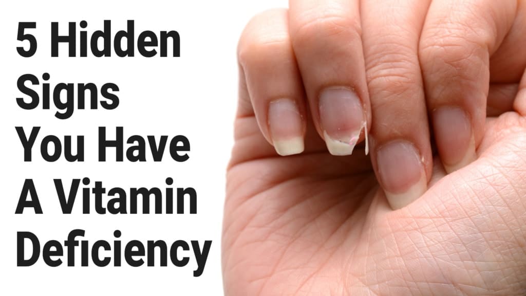 What Are The Signs Of Vitamin Deficiencies To Look For